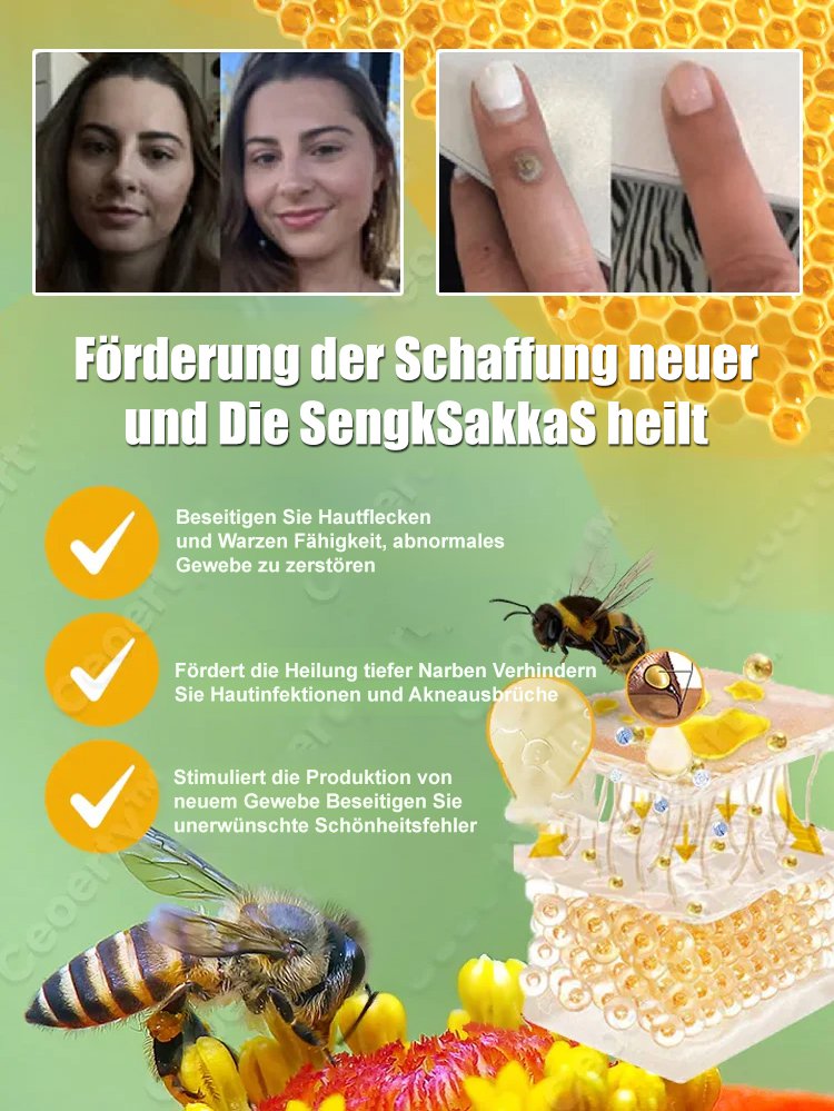 Körperpflege Warzenentfernungslösung