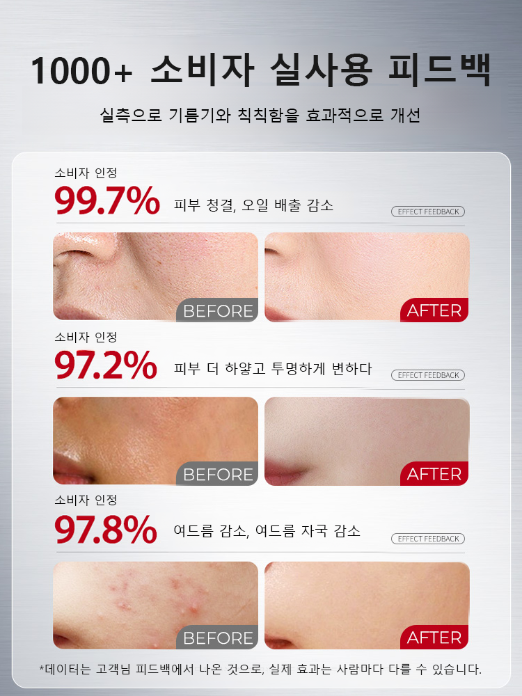 의료급 화이트닝 잡티 제거 클렌징 폼