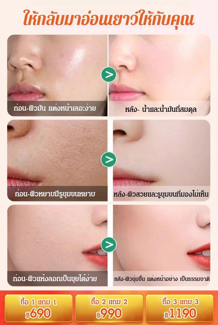 ครีมปรับสีผิว วิตามินซีห้าเท่า