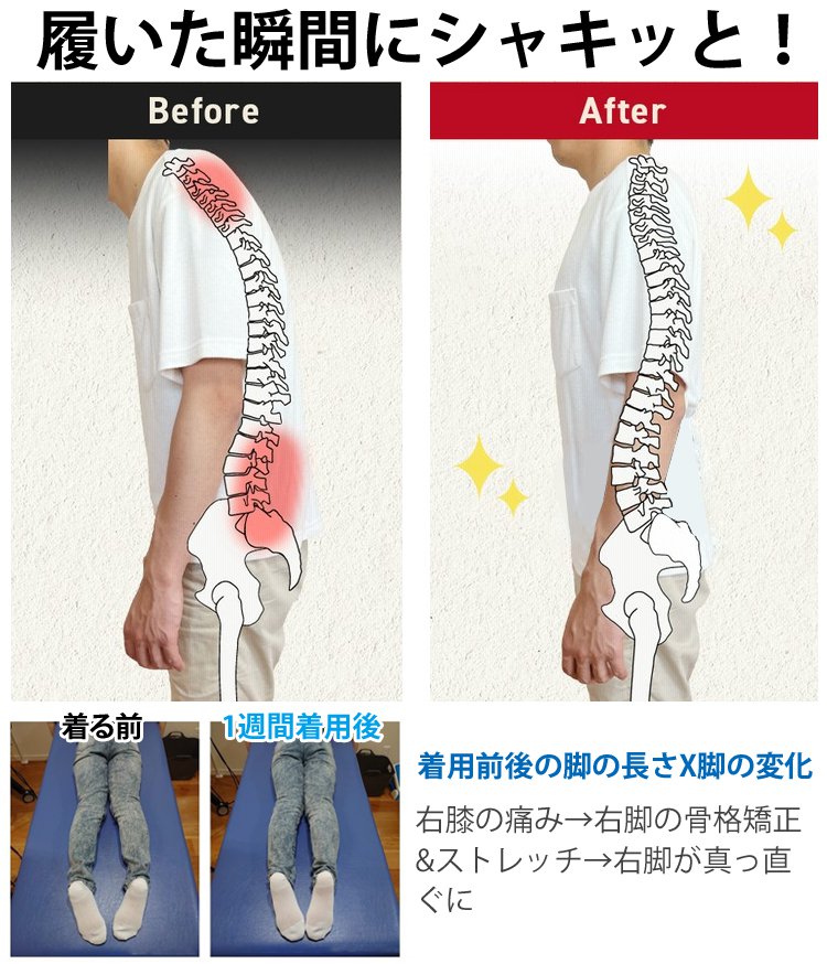 【日本の足関節外科の有名な医師も認める！】30日で扁平足を矯正する