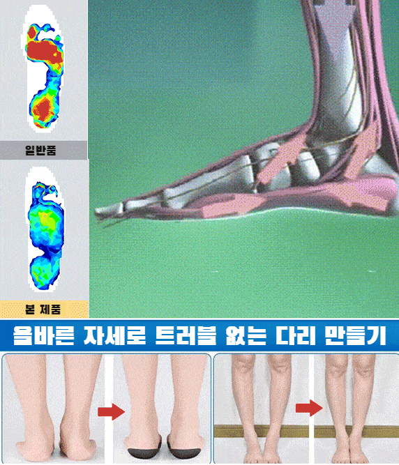 두꺼운 밑창 교정 슬리퍼