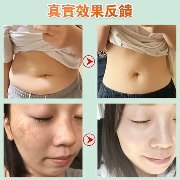 【潤腸養胃】黨參猴頭菇沙棘片 