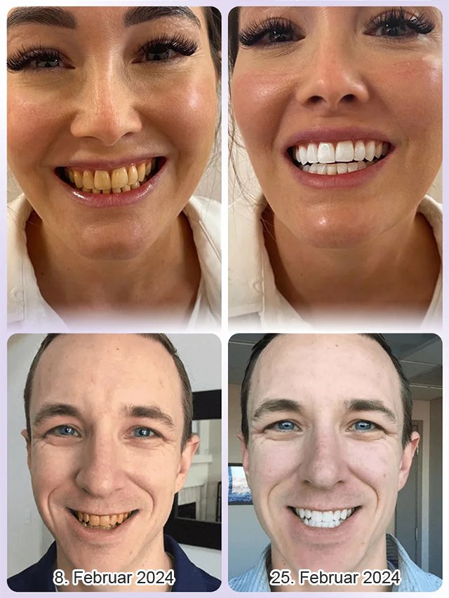 【Zahnpflege-Regeneration】Zahnreparatur und Aufhellung mit mineralischem Zahnpulver