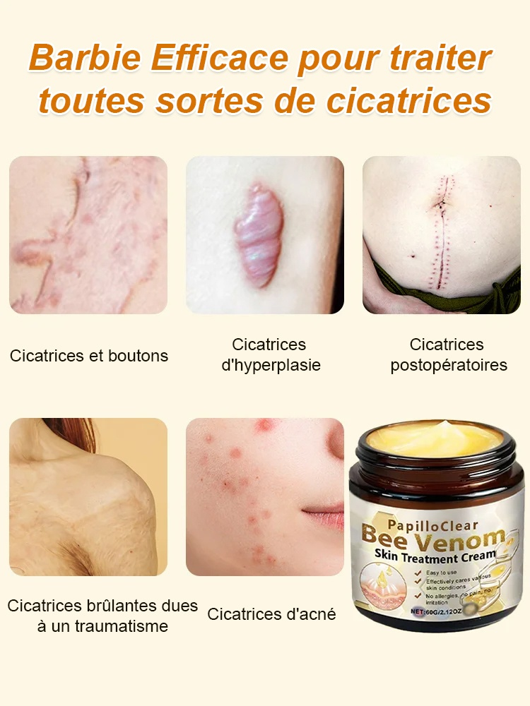 Crème lissante anti-cicatrice au venin d'abeille