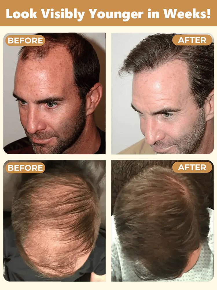 [Deep Nourishment] Hair Growth Activating Shampoo
