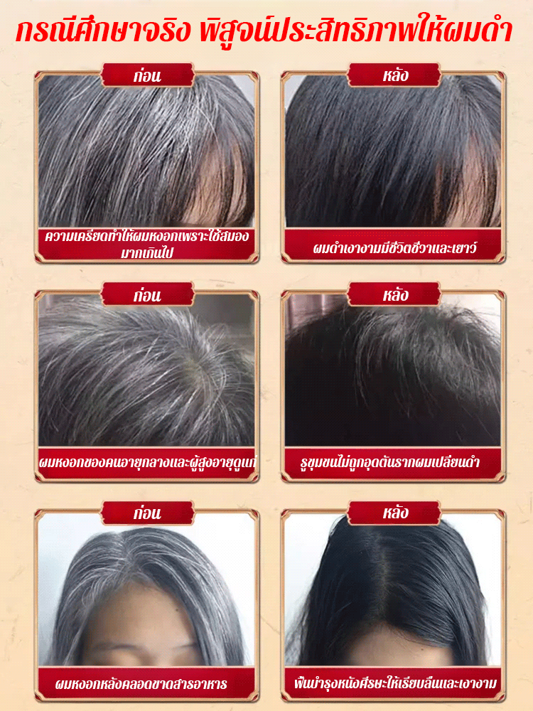 【ผมหงอกหายไปแล้ว】ลูกอมอัดเม็ดสูตรพืชสมุนไพรสีดำให้เส้นผมเปลี่ยนดำ