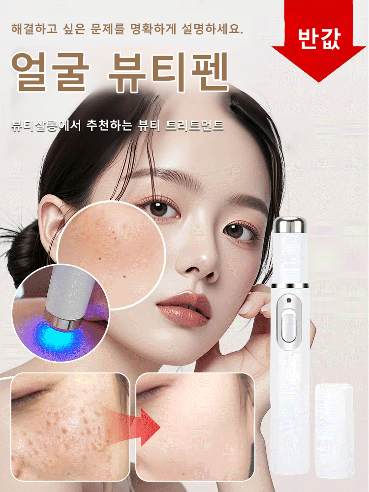 레이저 무통 사마귀 제거 펜