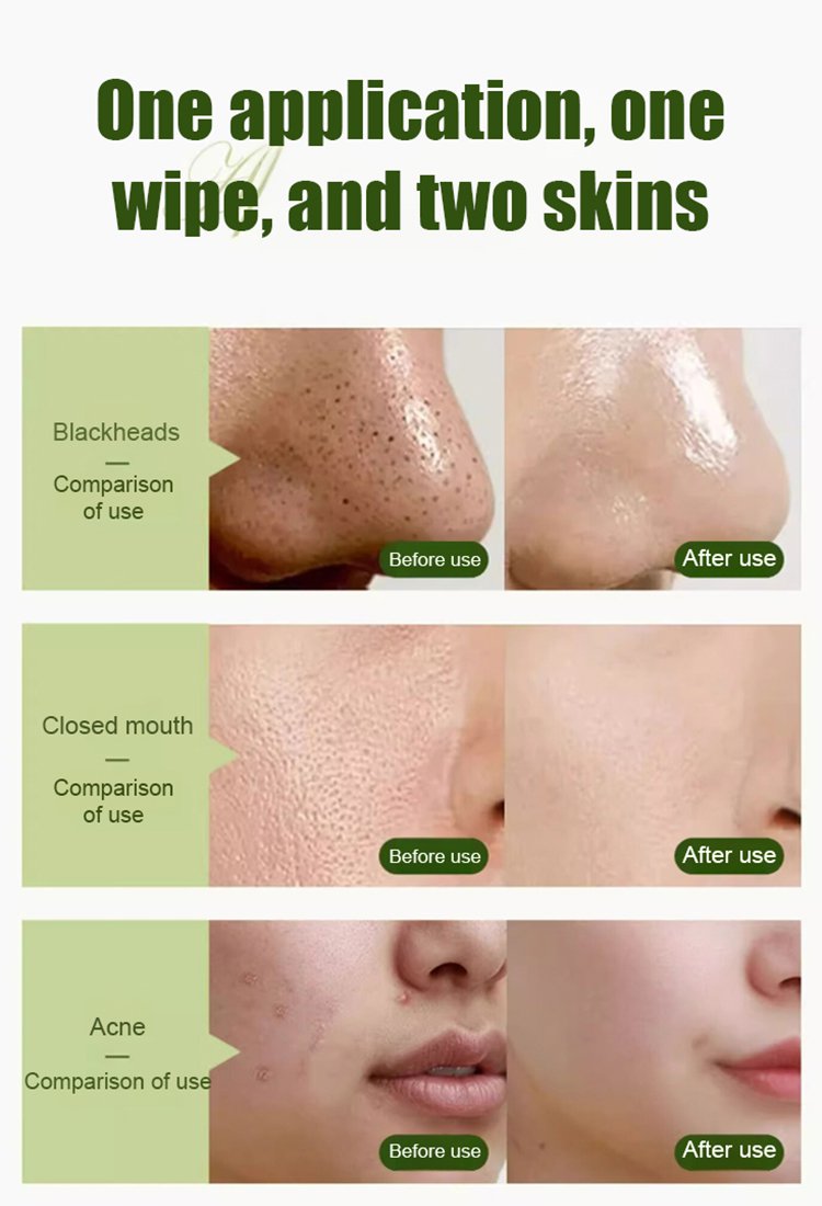 【Imported from South Korea】Centella Asiatica Anti-wrinkle Toner