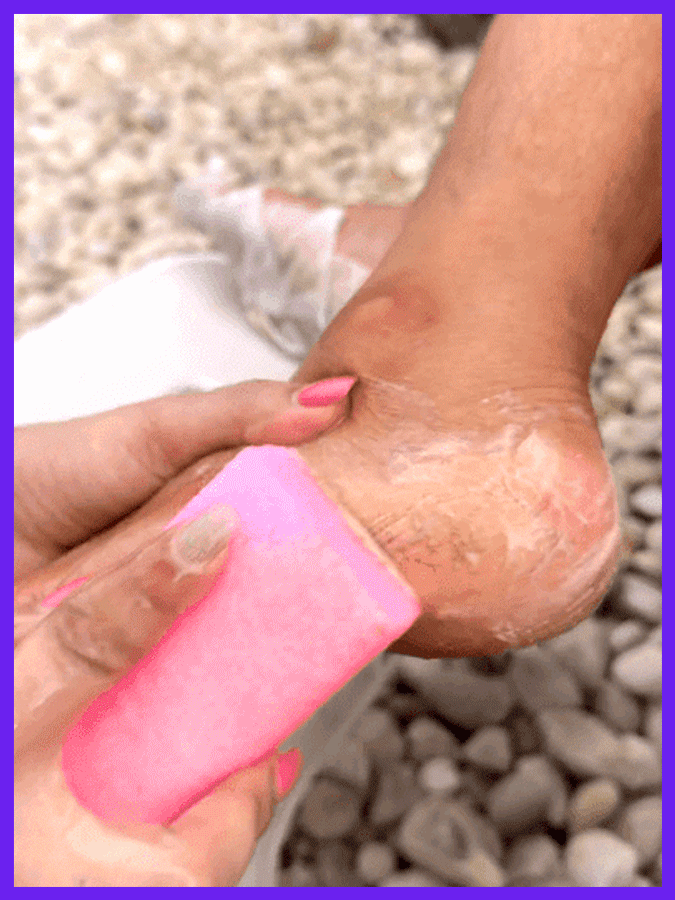 【Élimination des callosités de dix ans】Sérum exfoliant pour les pieds