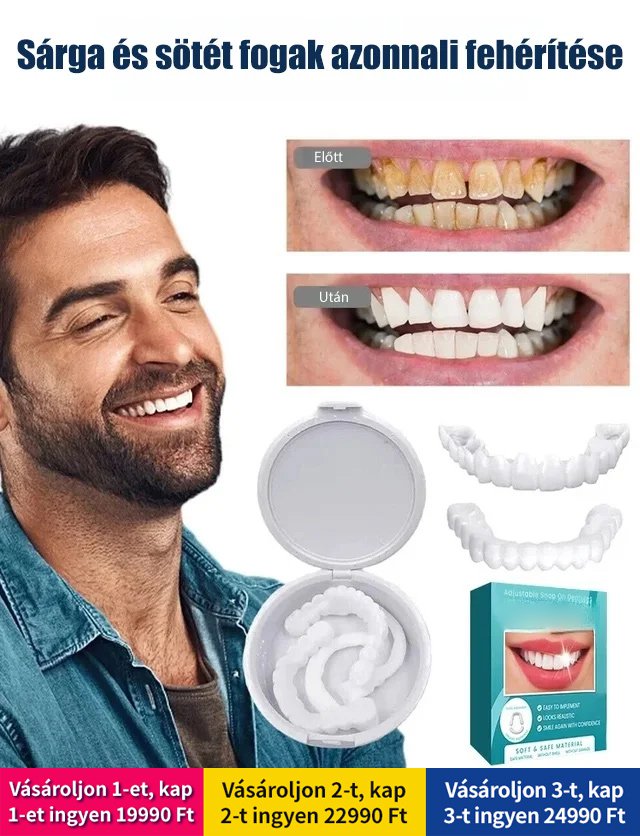 Állítható bepattintható műfogsor