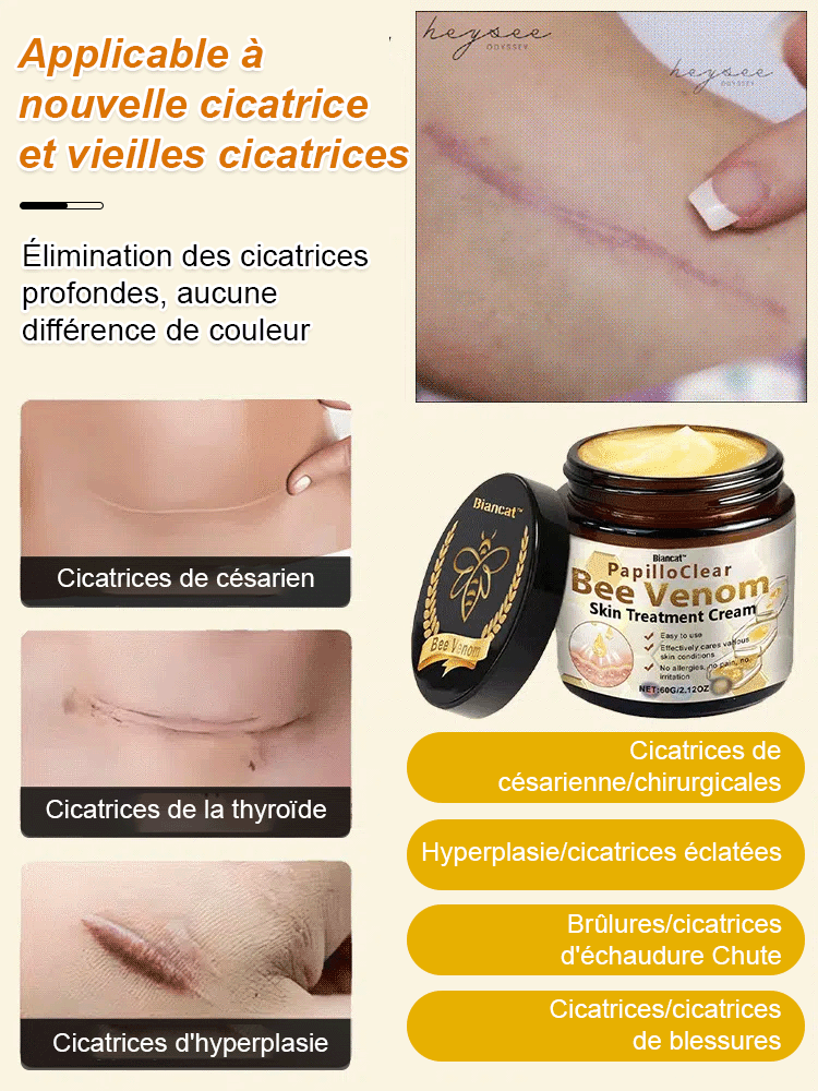 Crème lissante anti-cicatrice au venin d'abeille