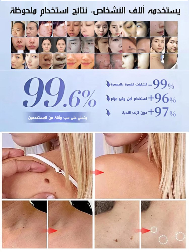 جل إزالة البقع الداكنة والشامات والشوائب المختلفة