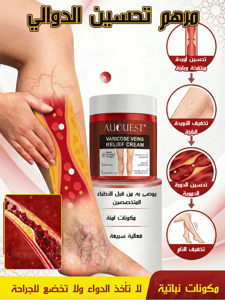 مرهم العناية بالدوالي