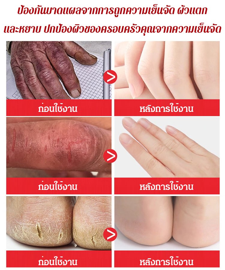 น้ำมันม้าทามือให้ความชุ่มชื้นและป้องกันการแตกร้าว