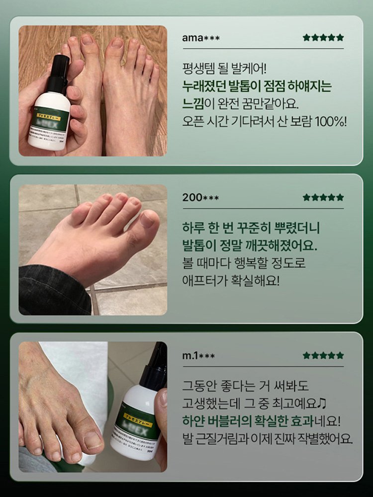 【3일 간지러움 완화】항균 발냄새 케어 스프레이