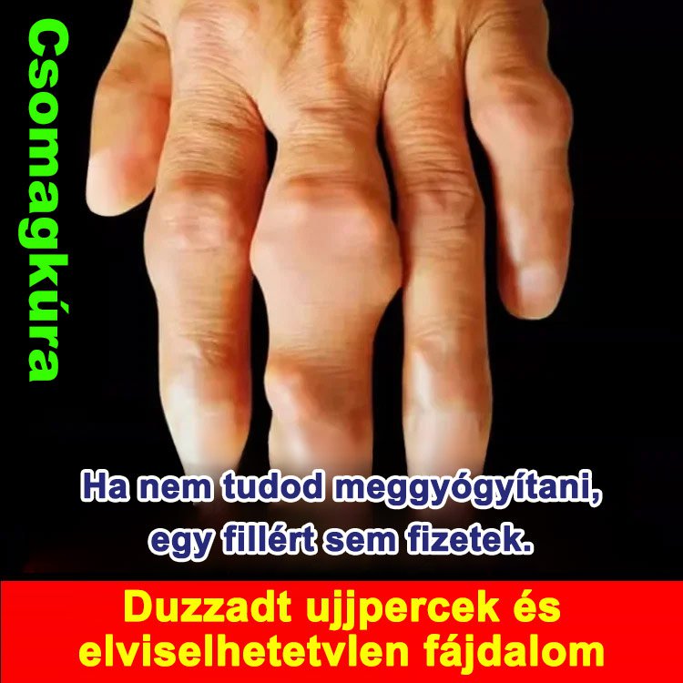 Izomlazító és fájdalomcsillapító Miaojiang ízületi balzsam