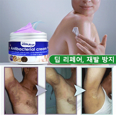 자화지정 피부 가려움 완화 크림