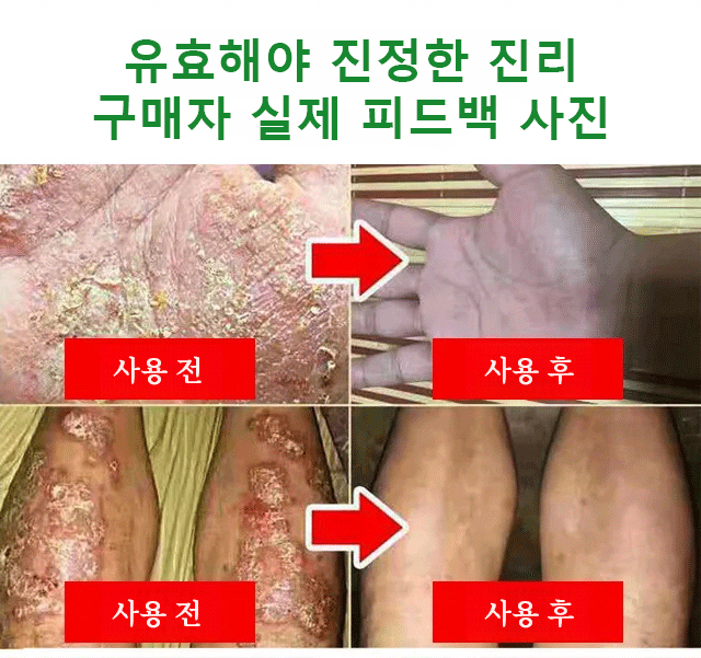 翻译件-X2022102703H-South-Moon紫花地丁皮肤止痒修护膏-wz_31.gif