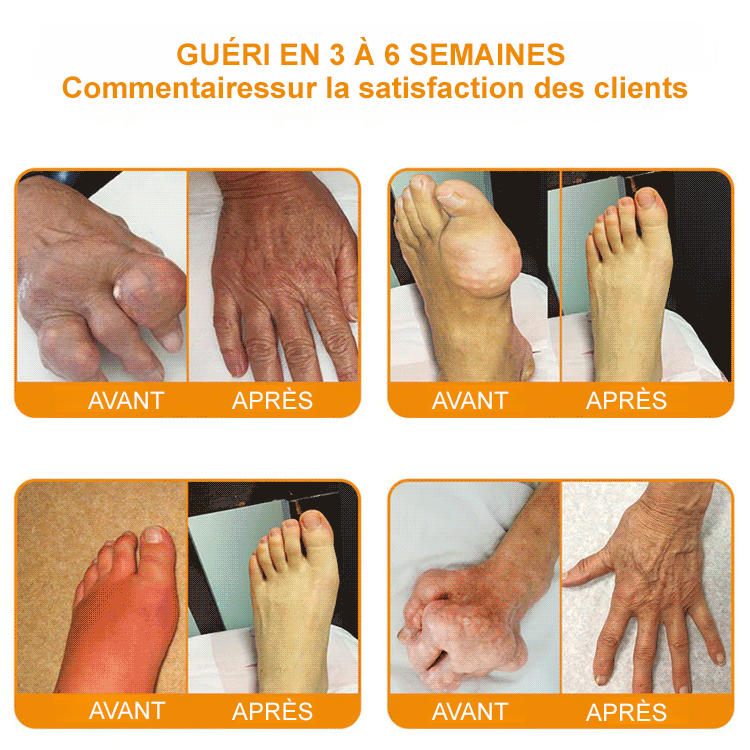 Laniska Crème Réparatrice pour Articulations au Venin d'Abeille