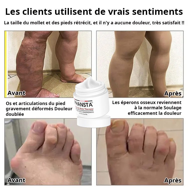 Crème de réparation des articulations et des os