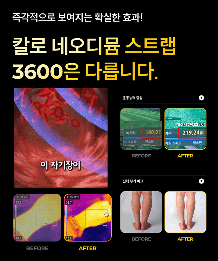 조절 가능한 에너지 팔찌