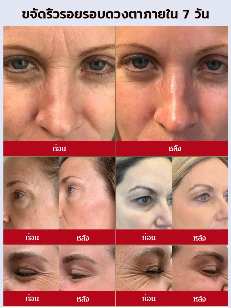 เรตินอลครีมบำรุงรอบดวงตาลดริ้วรอยและกระชับ