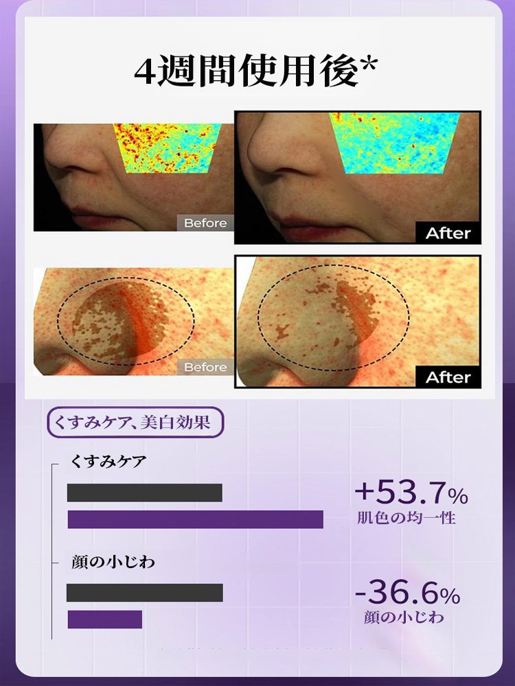 シワ取りアンチエイジングエッセンス