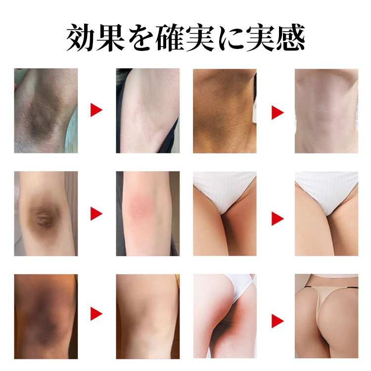 コウジ酸美白石鹸