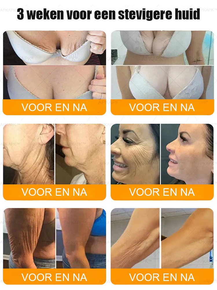 Bijengif uitgebreide verzorgingscrème