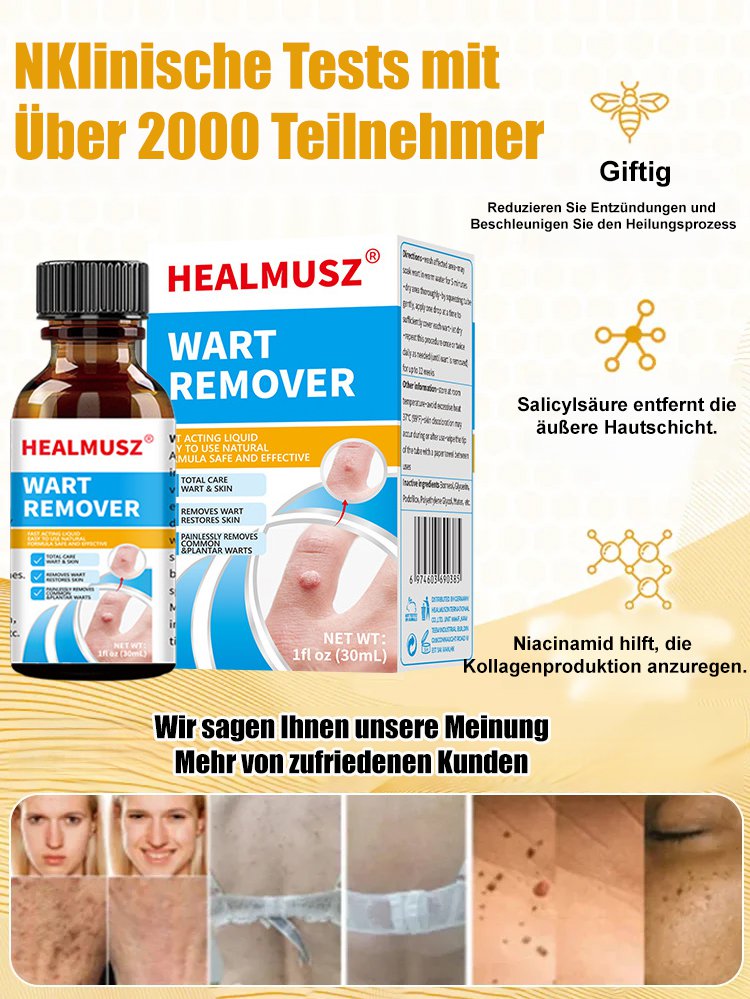 Körperpflege Warzenentfernungslösung
