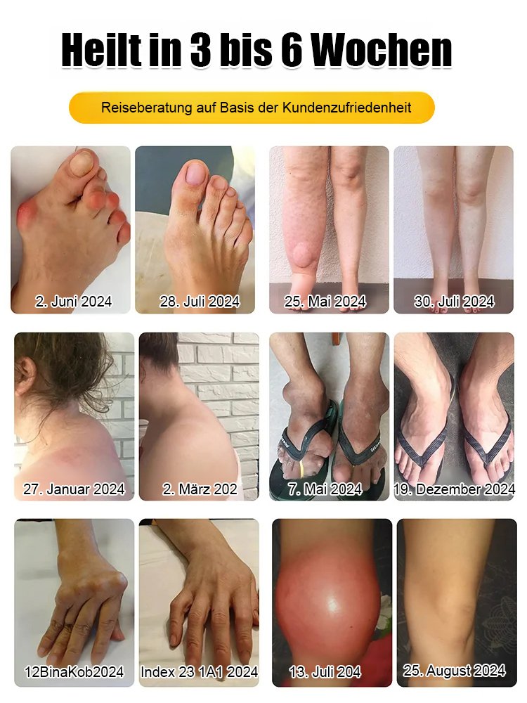 Bienengift-Schmerzstillende-Knochenheilcreme