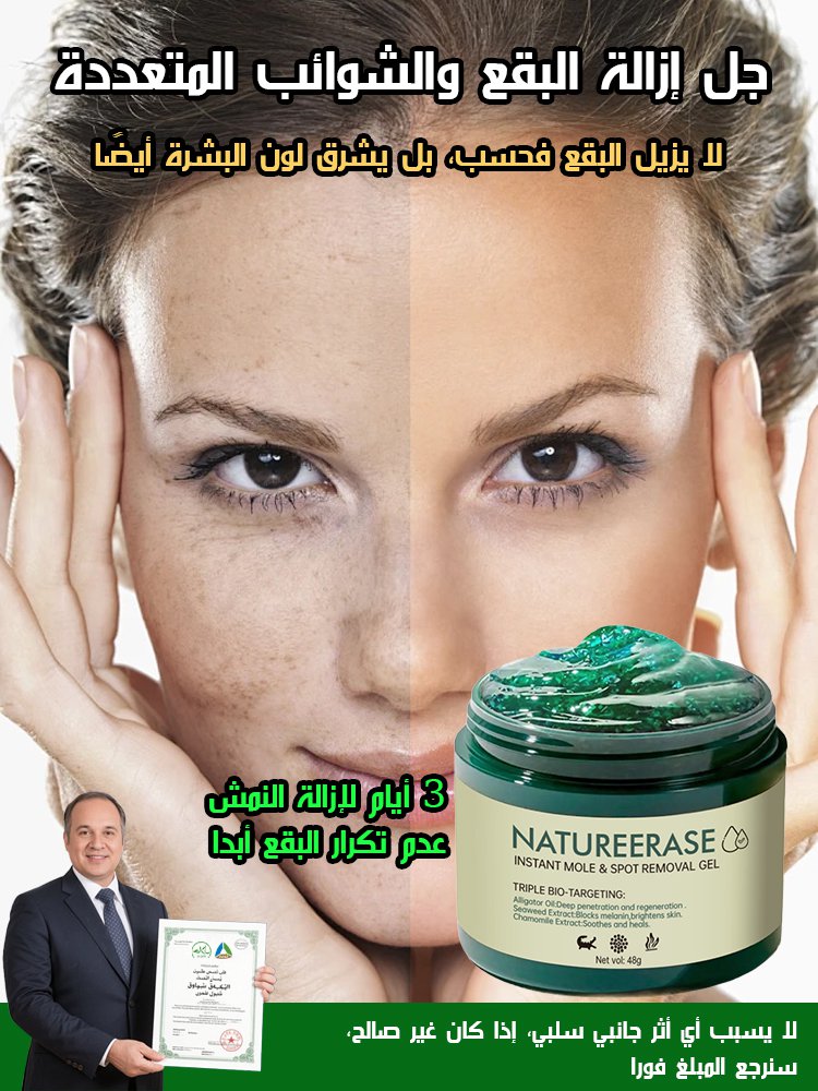 جل إزالة البقع الداكنة والشامات والشوائب المختلفة