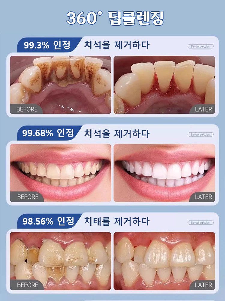 【한 번 닦으면 하얗게】의료용 등급 구강 보호 치약