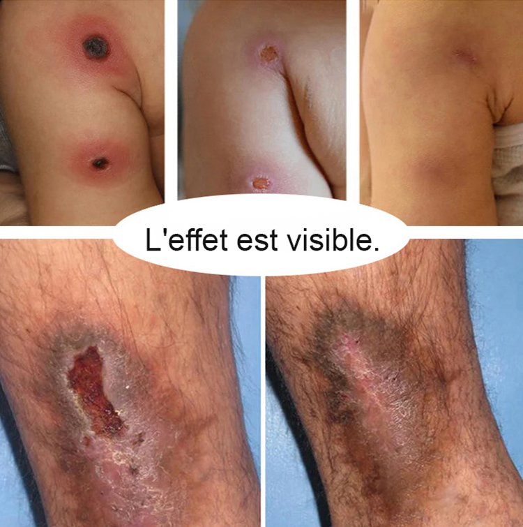 Bracelet intelligent de contrôle de la glycémie