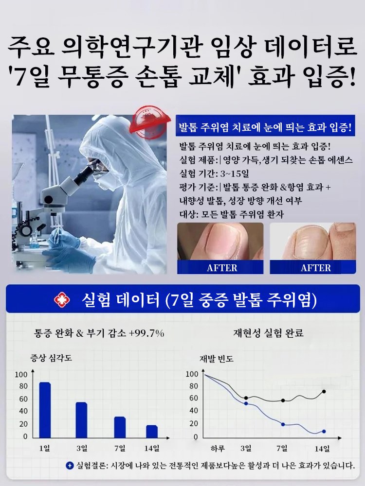 무좀 손톱 치료 에센스