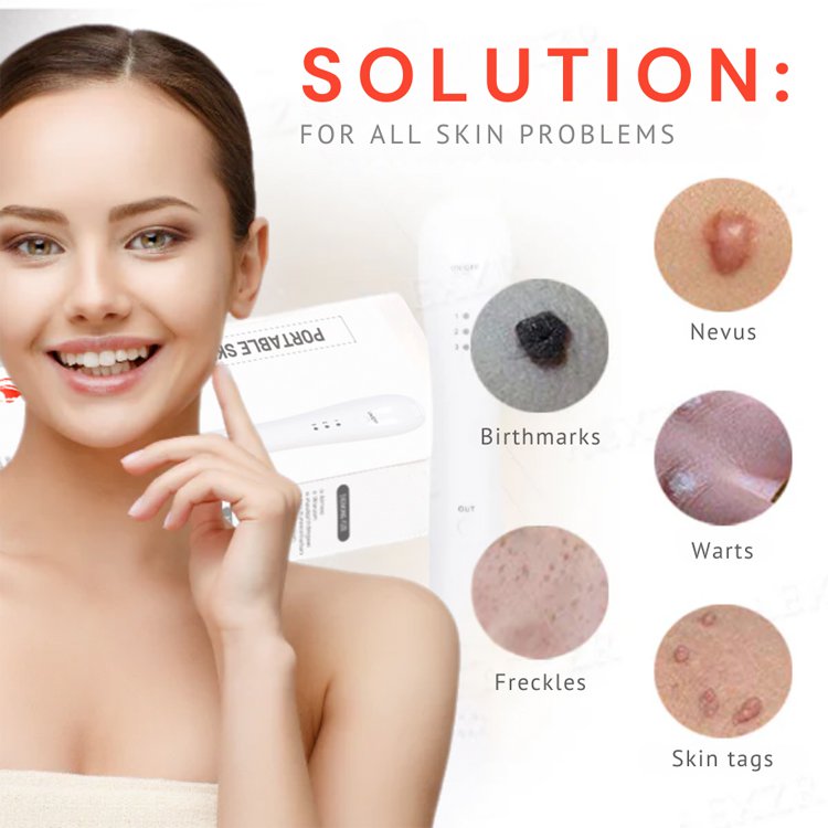 Instant Spot Cream