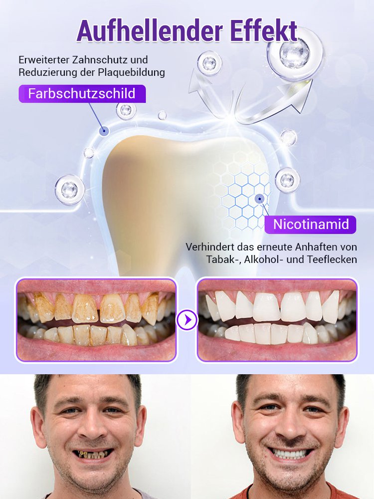 【Parodontale Gesundheit wiederherstellen】Zahnerneuerung lila Mineralzahnpulver