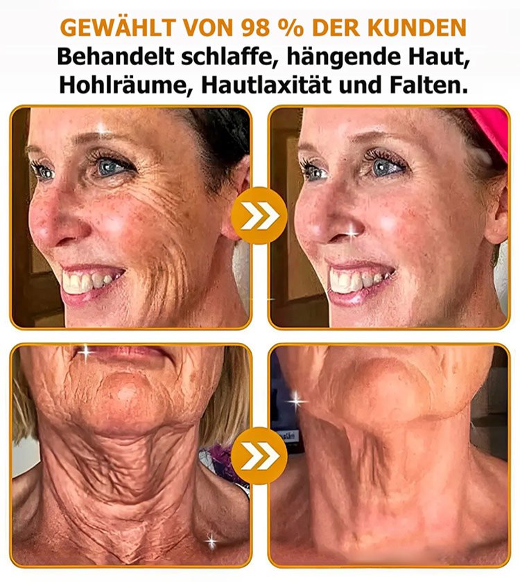 Botulinum Anti Falten Serum