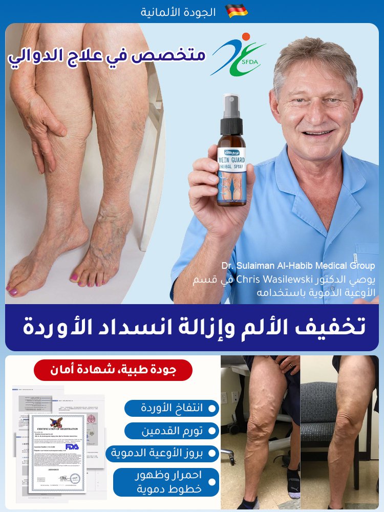 سائل العناية لتخفيف الدوالي والتورم