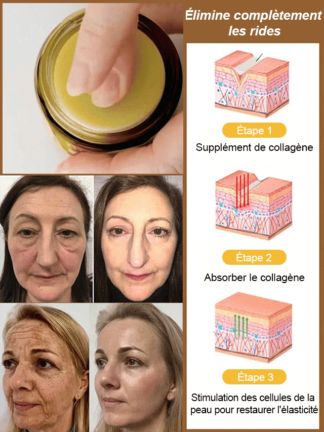 Crème lissante anti-cicatrice au venin d'abeille