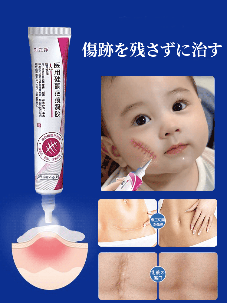 医療用シリコーン瘢痕ジェル