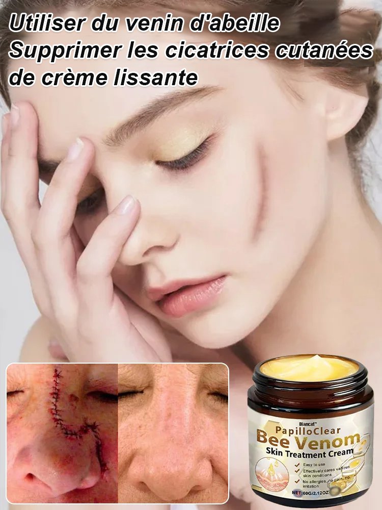 Crème lissante anti-cicatrice au venin d'abeille