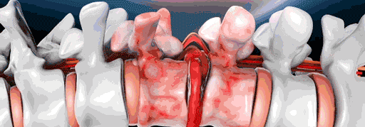 66a61a16d6e245a17025d633aa41a7d4.gif