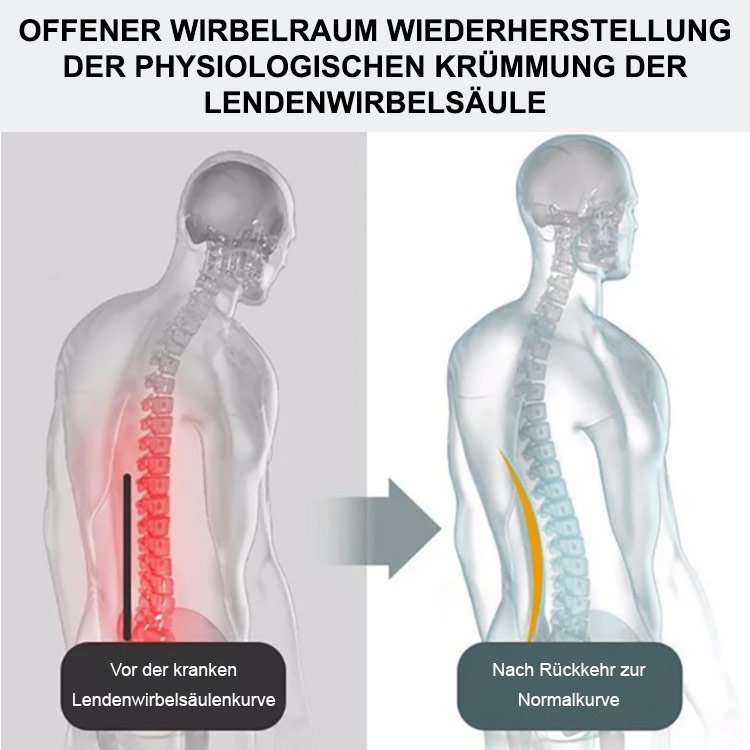 Erweiterte vergrößerte und verbreiterte Ischias Lendenwirbelstützgürtel