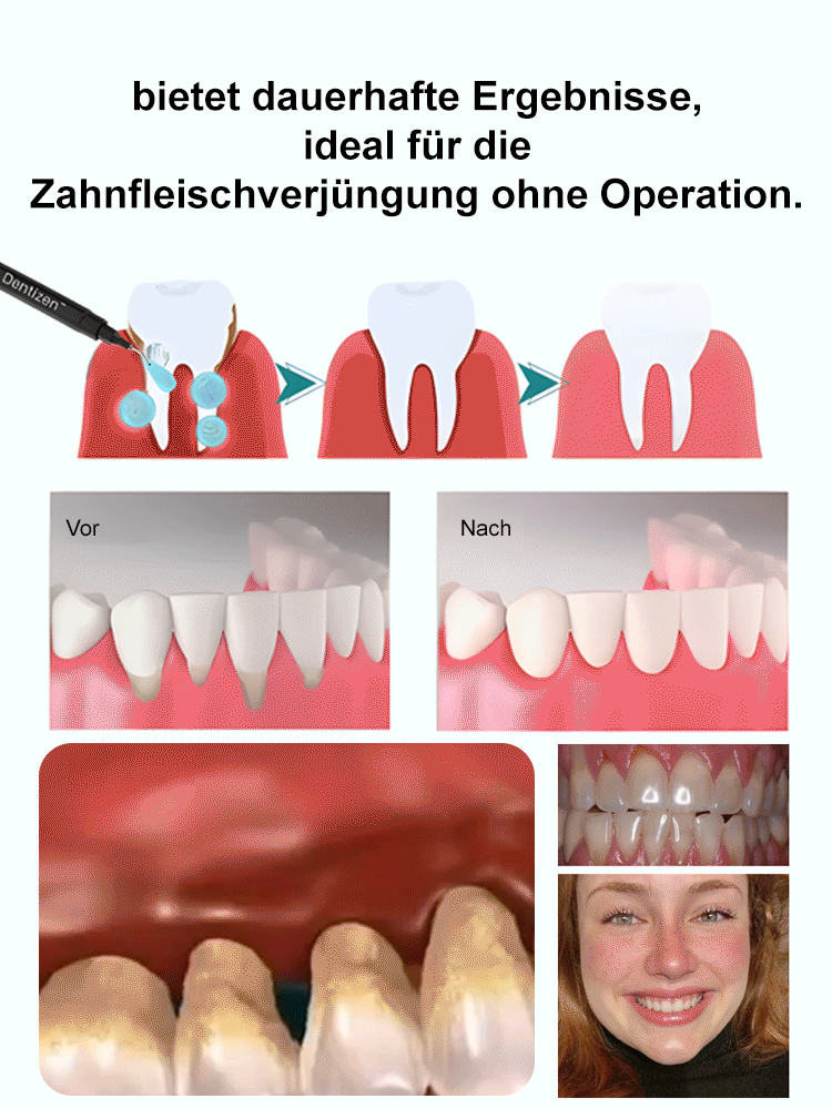 Oralhoe Zahnfleischschutzmittel