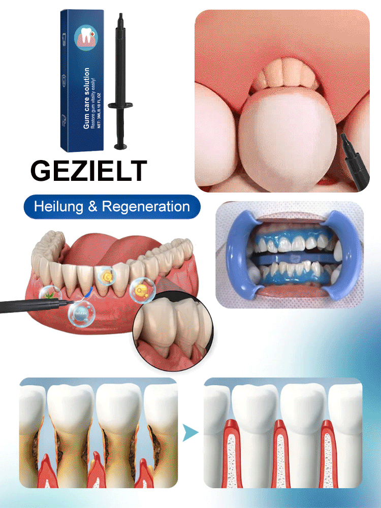 Oralhoe Zahnfleischschutzmittel