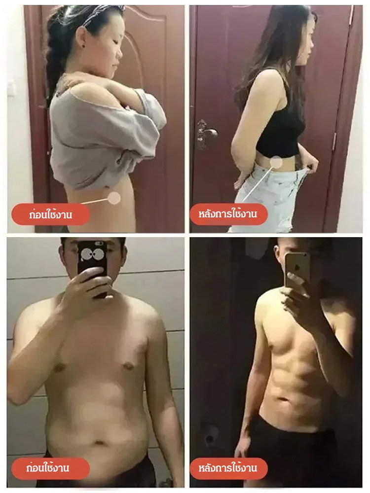 เครื่องนวดกัวซาไฟฟ้า