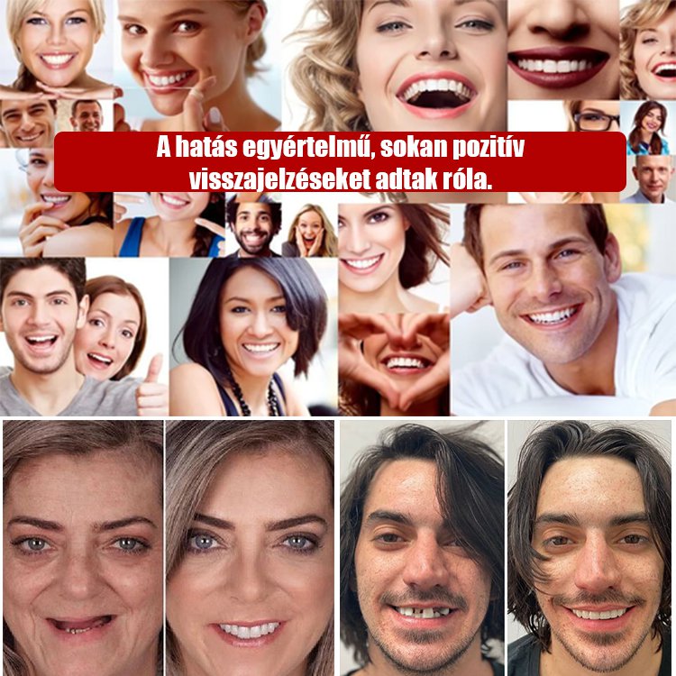 Fogászati kozmetikai műfog díszítő készlet