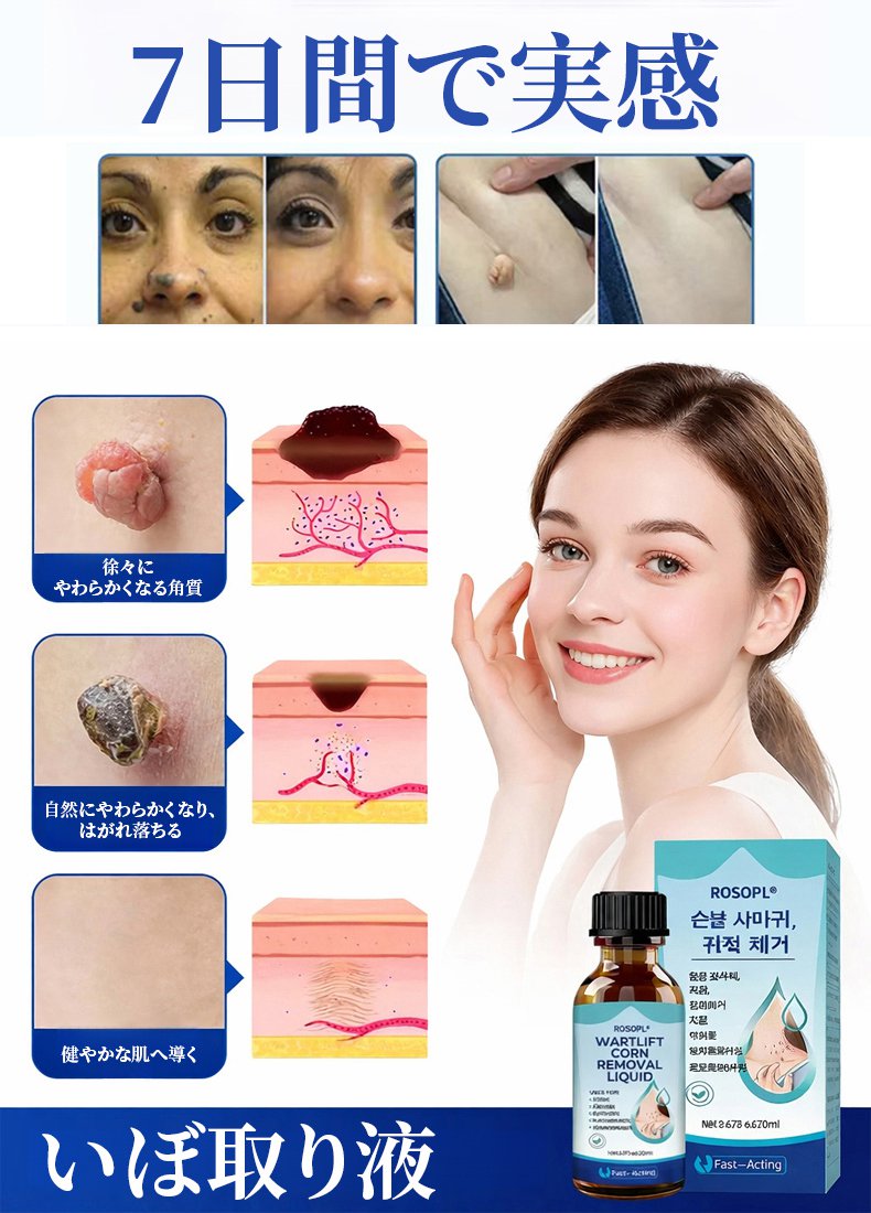いぼ取り液