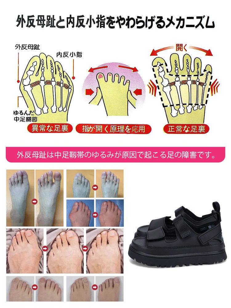 ファッションマジックテープカジュアルサンダル